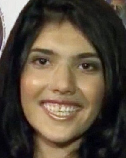 Afgan kız yeni burnuna kavuştu 13