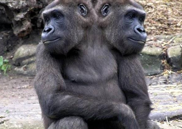 Siyam ikizleri görenleri şaşırtıyor 21