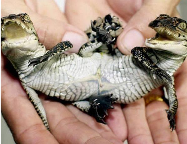 Siyam ikizleri görenleri şaşırtıyor 9