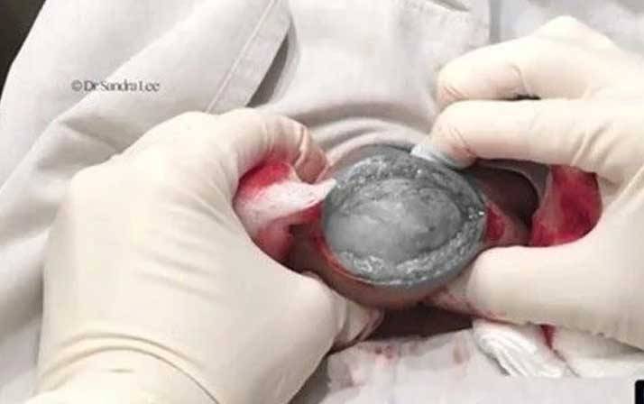 Yıllarca kafasında o canlıyla yaşadı! Doktora gitti şok oldu 10