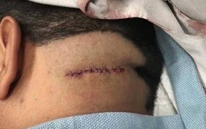 Yıllarca kafasında o canlıyla yaşadı! Doktora gitti şok oldu 12