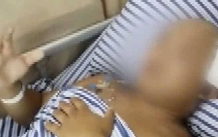 Yıllarca kafasında o canlıyla yaşadı! Doktora gitti şok oldu 3