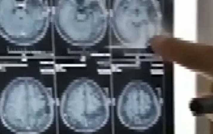 Yıllarca kafasında o canlıyla yaşadı! Doktora gitti şok oldu 4