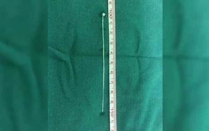 Yıllarca kafasında o canlıyla yaşadı! Doktora gitti şok oldu 6