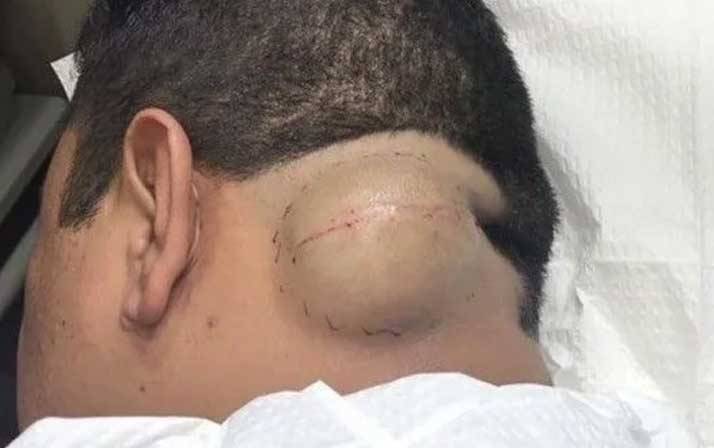 Yıllarca kafasında o canlıyla yaşadı! Doktora gitti şok oldu 7