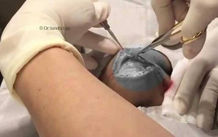 Yıllarca kafasında o canlıyla yaşadı! Doktora gitti şok oldu 9