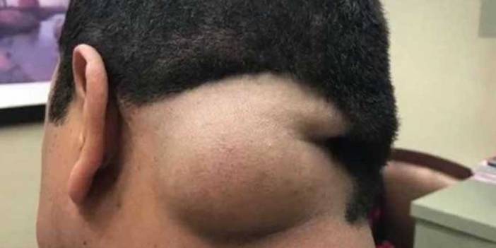 Yıllarca kafasında o canlıyla yaşadı! Doktora gitti şok oldu