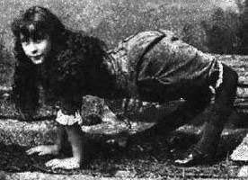 Milyonda bir görülen hastalıklar 24