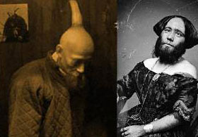 Milyonda bir görülen hastalıklar