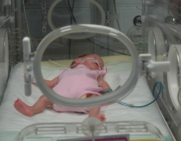 Doğmadan ölür denilen elif bebek yaşama tutundu
