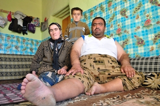 Aşırı kiloları nedeniyle zorluk çekiyor