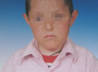 Zihinsel engelli çocuk kaza kurbanı oldu