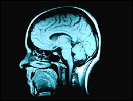 Alzheimer tedavisinde yeni umut