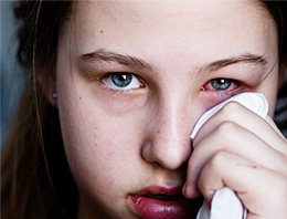 Göz kanaması ihmale gelmez!