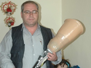 Protez bacağını geri verecek