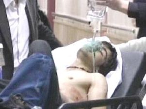 Konya'da bıçaklı kavga: 1 yaralı
