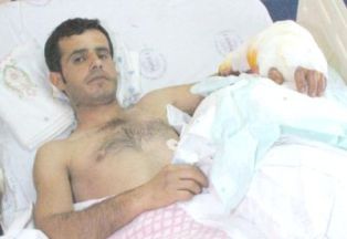 Kopan kolu 8 saatlik ameliyatla yerine dikildi