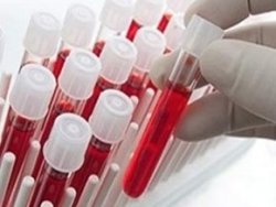 Kan grubu A olanlar bu habere dikkat