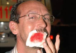 Yazarımız Akgül, ölümden döndü