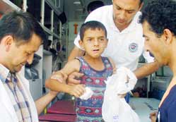 Yuttuğu bilye yemek borusuna takıldı