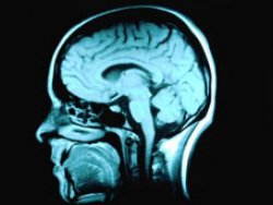 İki dil bilmek beyni güçlendiriyor