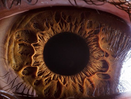 Körler için yeni umut