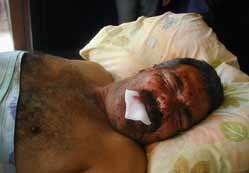 İşçilerin üzerine toprak kaydı