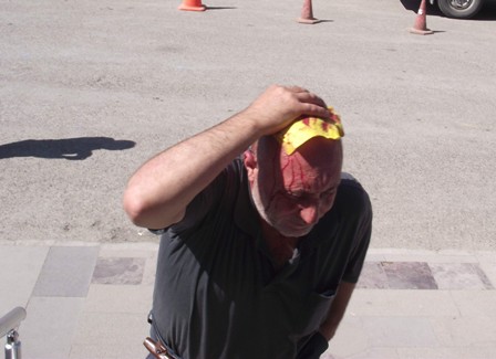 Çatıdan düştü yaralandı