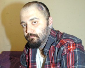 Kanser mi o da neymiş?
