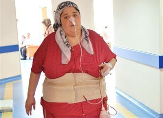 Çocuk sahibi olmak için midesini küçülttü