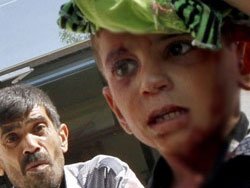 Azaz'a hava saldırısı: 80 ölü