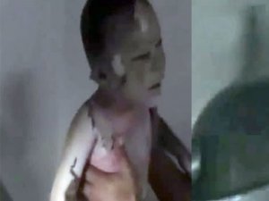 Suriye'de çocuğa kimsayal silah iddiası