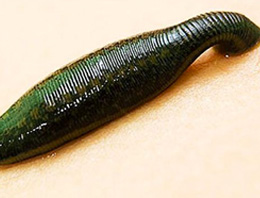 Boğazındaki sülükle 5 gün gezdi