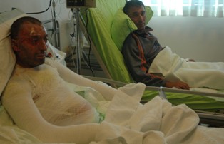 Doktorları şaşırtan gelişme