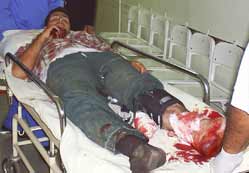 Çat köyü muhtarı vuruldu