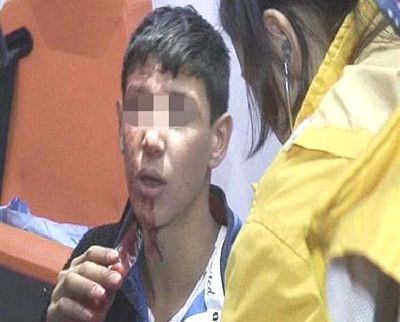 Hırsız diye dövülen çocuk, madde bağımlısı çıktı