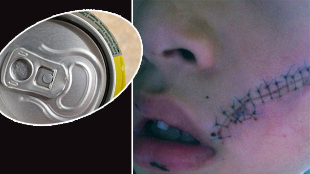 Bir anlık hatanın bedeli ağır oldu