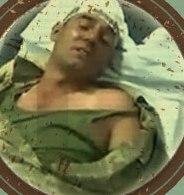 Yaralı asker dehşet anlarını anlattı