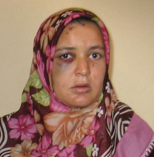 Hamile karısını darp etti