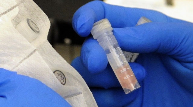 Menenjit salgınında ölü sayısı artıyor