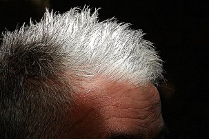 Saçınız erken beyazlıyorsa aman dikkat!