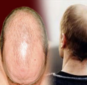 Eski sağlıklı saçlarınıza yeniden kavuşun