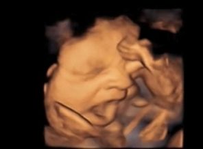 Anne karnında esneyen bebek! VİDEO