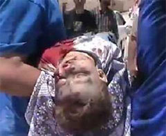 Esed 81 çocuğun kanına girdi