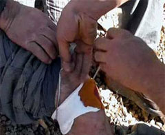 Türk  Askerleri   PKK'ları  tedavi etti