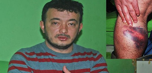 Polisin orantısız gücü komalık etti