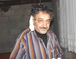 Eve bakmayan kocasının kulağını kesti