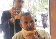 Parkta otururken kulağı ısırıldı
