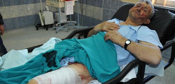 Sivas'ta iki kişi domuz saldırısına uğradı