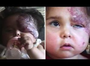 Bu bebeği Amerika böyle yaptı!